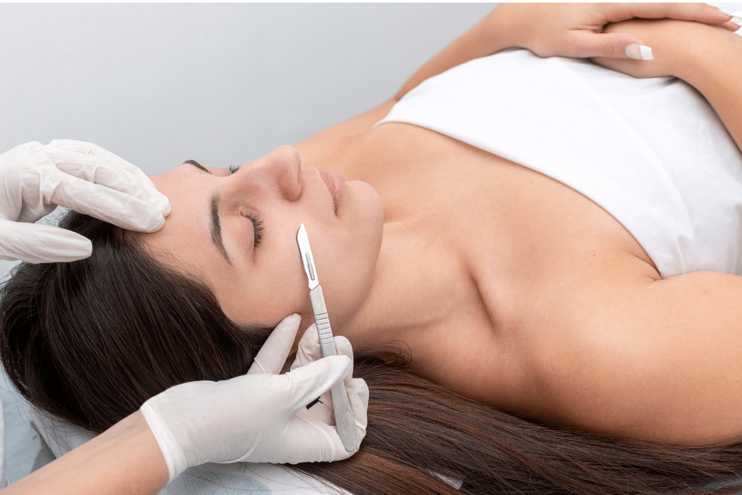 dermaplaning